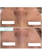 クレア(Clair)/アンストレス症例