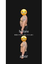 ロリノ(LOLINO)/ビフォー、アフター