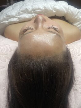 白雲木/頭皮ハーブピーリング