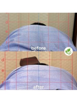 カイロプラクティック ネクサス/側湾と足のしびれを撃退☆