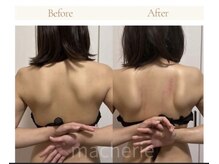 マシェリ(ma-che'rie)/3D肩甲骨剥がし+デコルテほぐし