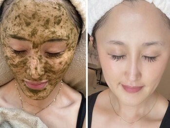 ル メルシェ(Lemerci)の写真/つるんと陶器肌!!《大人気★国産ハーブピーリング¥9,000》お肌の内側から"育てて整える"輝く艶肌に♪