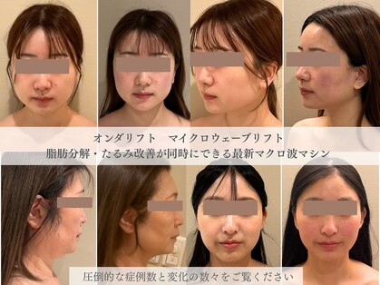 リビア(LIVIA)の写真