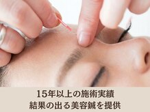ピュアハリ/15年以上の施術実績