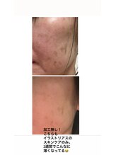 スイートルーム(Sweet Room)/クリスティーナのイラストリアス