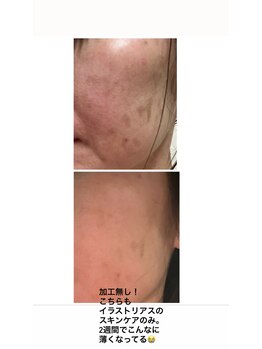 スイートルーム(Sweet Room)/クリスティーナのイラストリアス