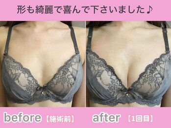 サラエクセレント 心斎橋(SARA EXCELLENT)/バストアップでカップ数UP♪育乳