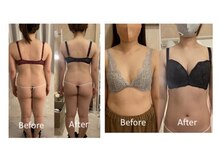 レーヴ(Reve)/くびれ形成/バストアップ/下垂