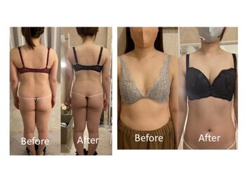 レーヴ(Reve)/くびれ形成/バストアップ/下垂