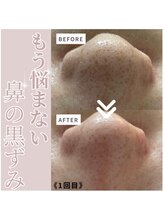 ママニエ(ma maniere)/黒ずみ毛穴ごっそり！毛穴洗浄