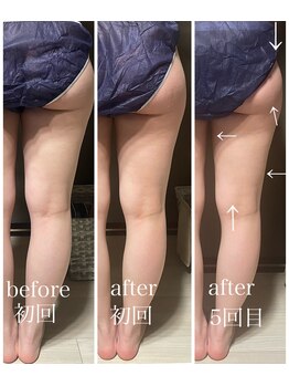 イーストモア(EAST MOIS)/太もも集中セル撃退！！