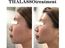 ルノン(LUNON)/タラソトリートメント