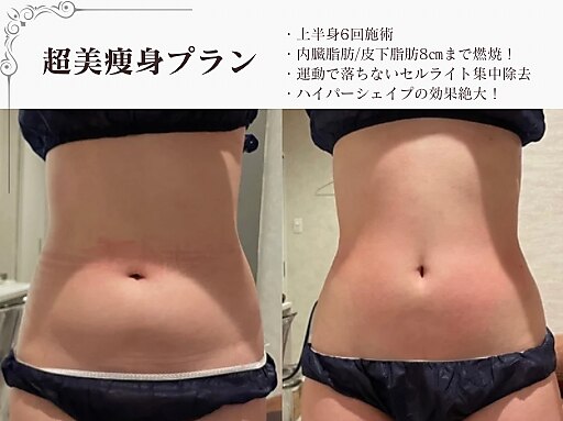 ラブミー 渋谷本店(LoveMe)｜ホットペッパービューティー