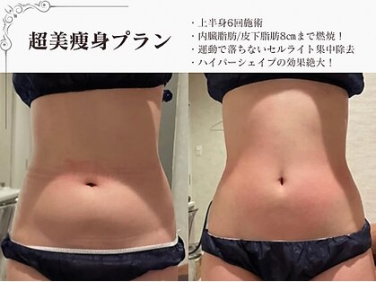 ラブミー 渋谷本店(LoveMe)の写真