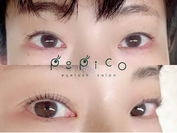 ポピコと種爪 西荻窪/マツパビフォアーアフター