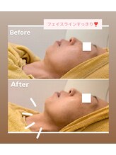 クレール 小山店(CLAIR)/【たるみ改善】