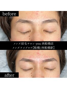 ユー 西船橋店(you)/ビフォーアフター写真