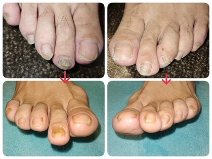 フットケアサロン ラビフット(Rabbi foot)の写真