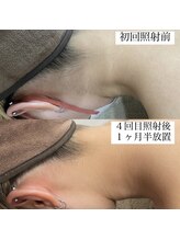 テンパ ビューティー(+10%beauty)/効果写真