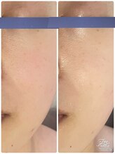 リッチベル(richbelle)/