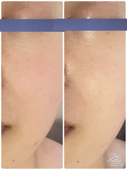 リッチベル(richbelle)/