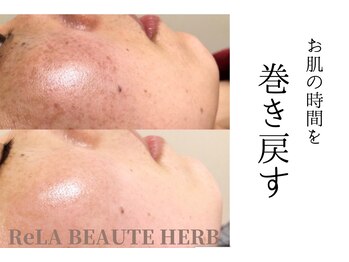 リノ トータルビューティサロン(lino total beauty salon)/ハーブトリートメント