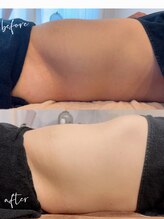 ルシェリアノーブル(le cherien noble)/キャピゼロ