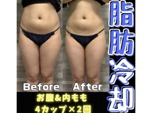 恋サロン 巣鴨店(恋salon)の雰囲気（脂肪冷却の効果を感じてください）