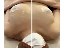 アンドボディ 横浜元町(&Body)/バストアップ片方のみ施術