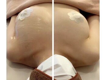 アンドボディ 横浜元町(&Body)/バストアップ片方のみ施術