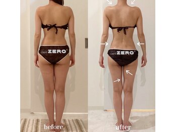 エイプリル/【痩身】比較写真