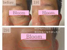 ブルーム(BLOOM)の雰囲気（クマもくすみも肌荒れも一度で解消できるのはWISHproだけ！）