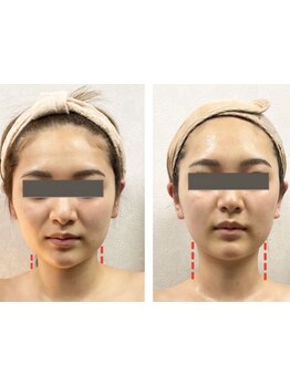 短期集中コースのあるサロン