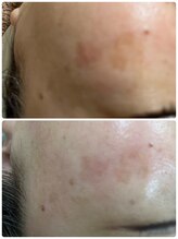 ルーメ(lume)/30代女性