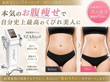 グラツィア つくば駅前店(Grazia)の雰囲気（[つくば駅/小顔/フェイシャル/毛穴/脱毛/ボディ/ブライダル]）