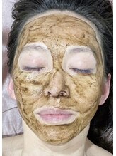 ラティメリア(Latimeria)/本気の肌質改善ハーブピーリング