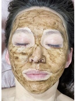 ラティメリア(Latimeria)/本気の肌質改善ハーブピーリング