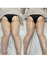 リリー(Lily)/【通いたい放題】