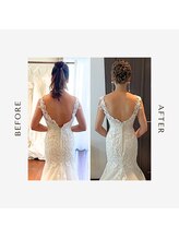 ルーチェビューティープラス(LUCE' beauty +)/ブライダルエステ