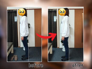 セレナ 川越/骨盤矯正と全身施術で姿勢改善!