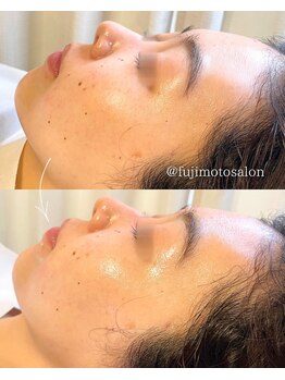 フジモトサロン 那覇おもろまち店(fujimotoサロン)/艶肌