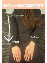 ヨサパーク ミミン(YOSA PARK mimin)/リンパマッサージでむくみ撃退