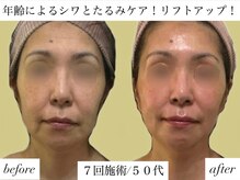 サロンハート(Salon Heart)