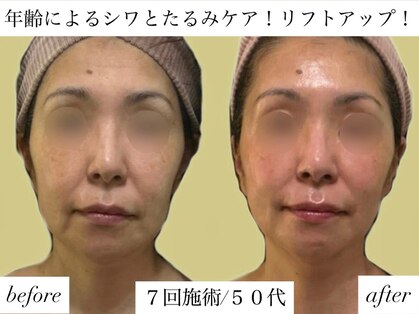 サロンハート(Salon Heart)の写真