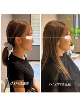 プライミー(PRIMY)/フェイスラインを整える