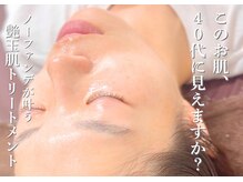 40代モニター様シミ/毛穴からの解放!最速で肌変化韓国発肌管理