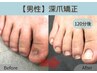【男性限定モニター】お足元深爪矯正¥ 36,300 →¥ 23,100 自爪風仕上げ◎