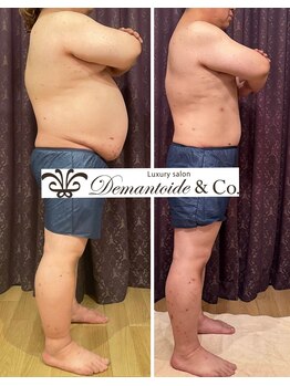 デマントイド 倉敷(Demantoide&Co)の写真/【結果重視の本気メンズ痩身】機会に頼らないオールハンドで脂肪、姿勢、体質を根本改善へ☆