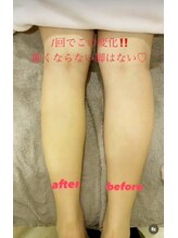 メディカルエステ 大宮店/痩身/痩身/痩身/痩身/痩身/痩身/