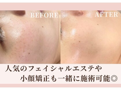 ハナハナ(hanahana)の写真